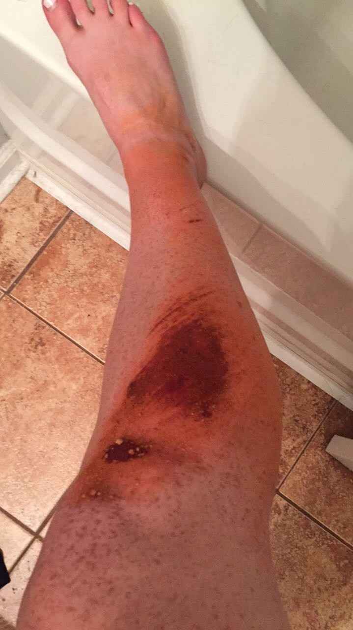 Well this happened last night....