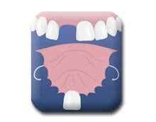 OMG!!! 4 Days and the worst has happened....