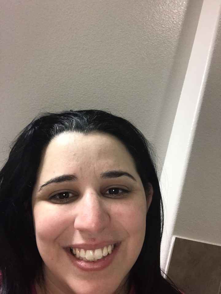 Help!! Woke up with a small whithead pimple 8 days before wedding!! - 1