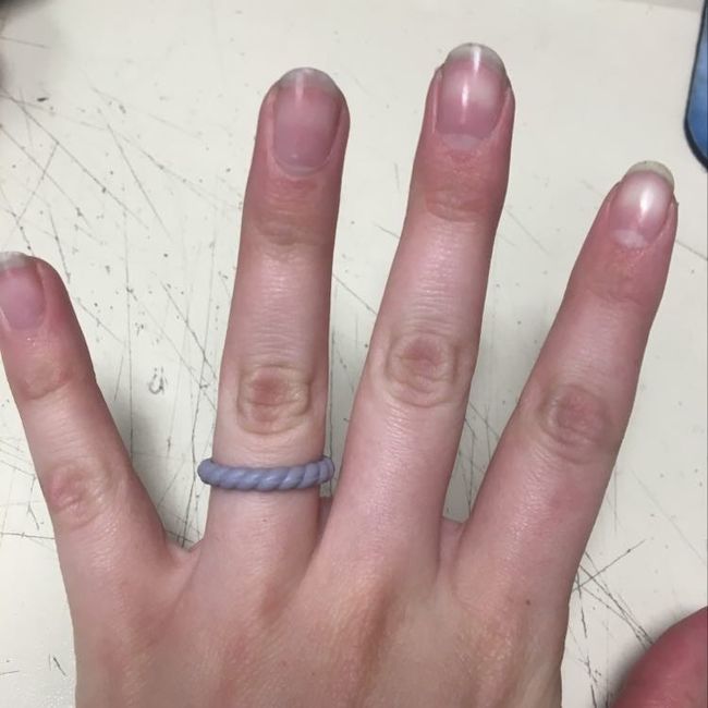 Uno más ring post