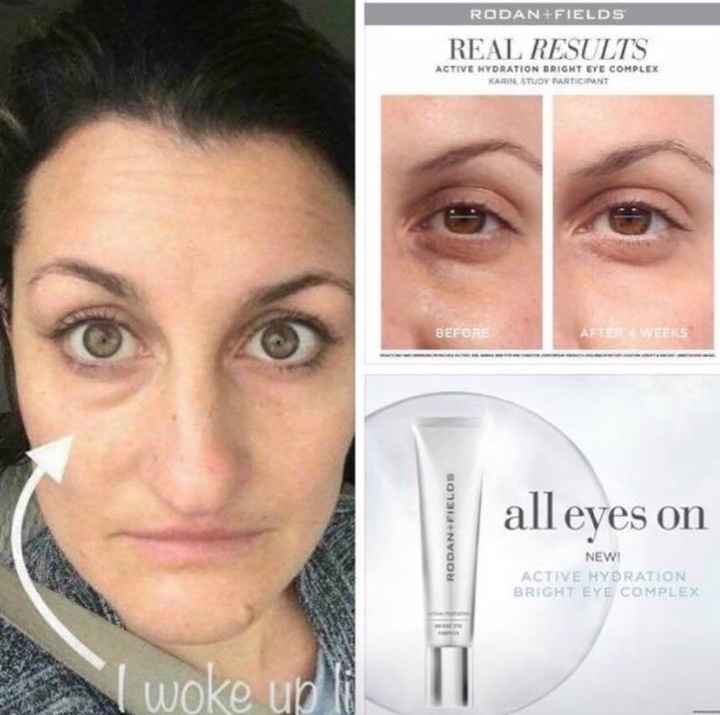 Bright eye complex before and after