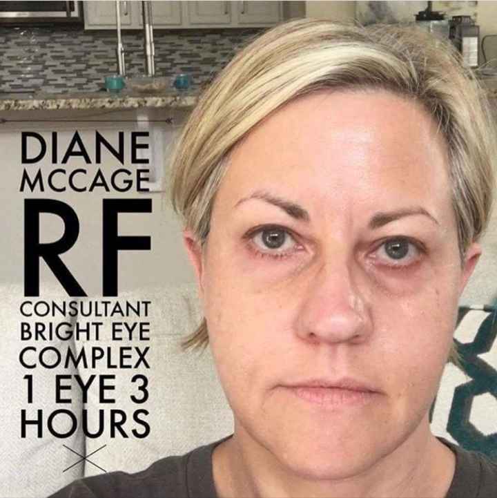 Bright eye complex before and after