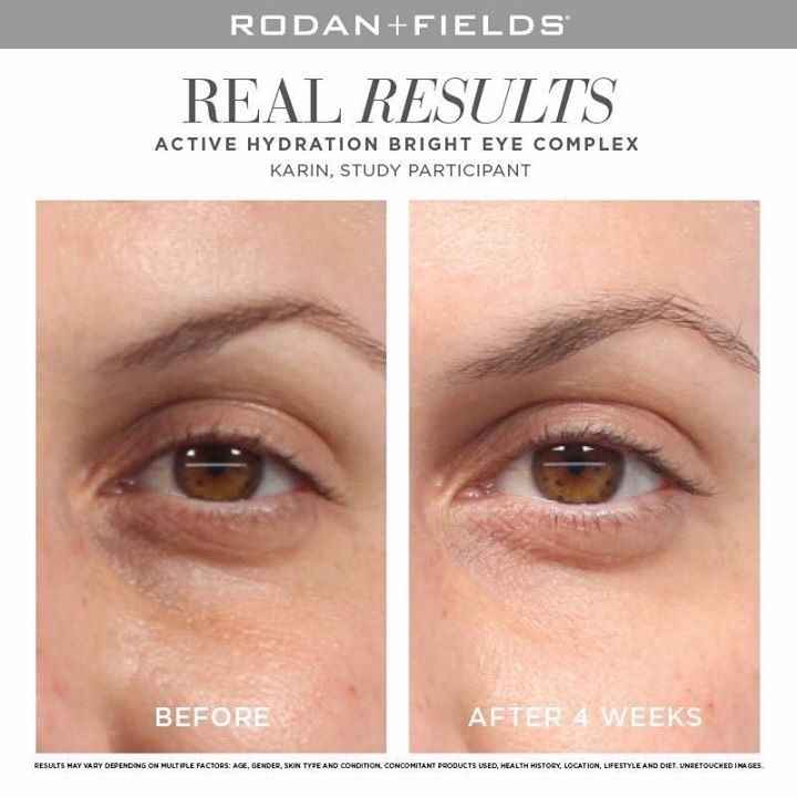 Bright eye complex before and after