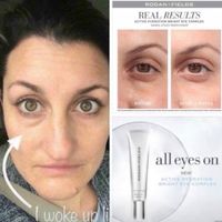 Bright eye complex before and after