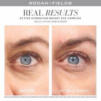 Bright eye complex before and after