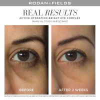 Bright eye complex before and after