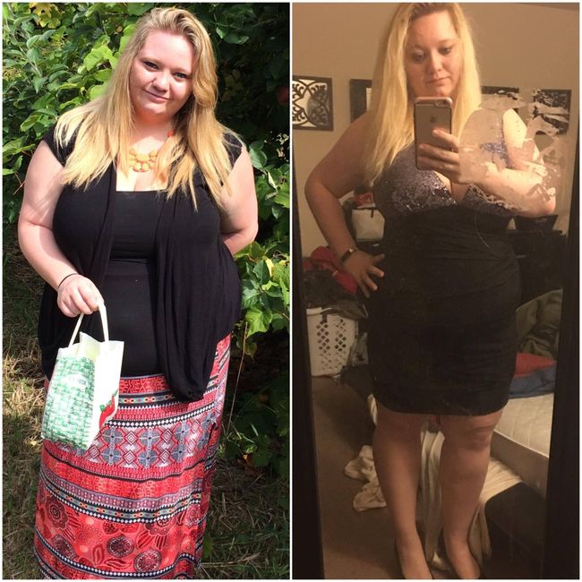 Major weight loss