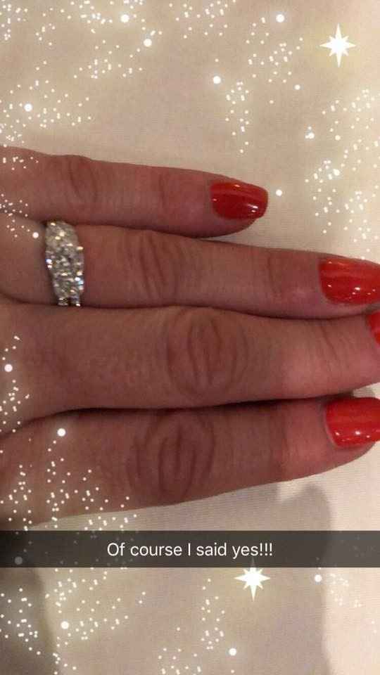 My ring 