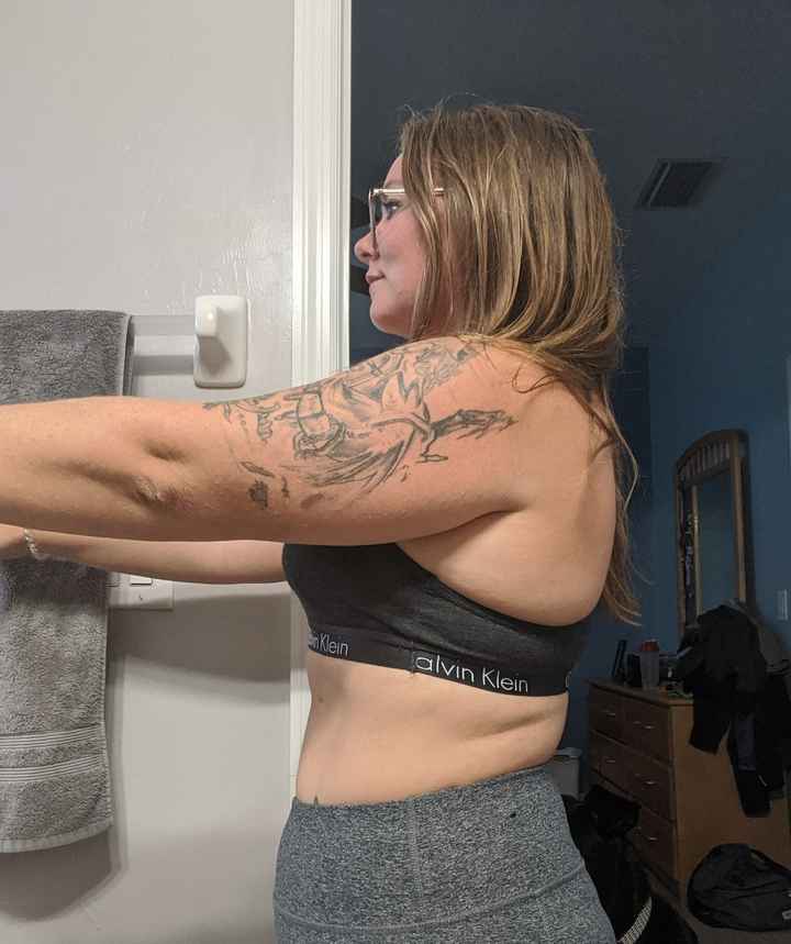 Arm Sculpting? Is it possible? - 1