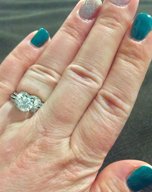 Band for my E-Ring.. did anyone have this problem?