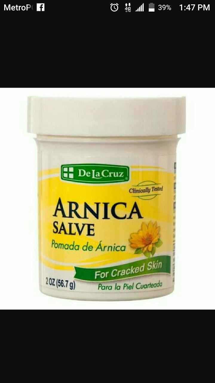 Attack of the Eczema