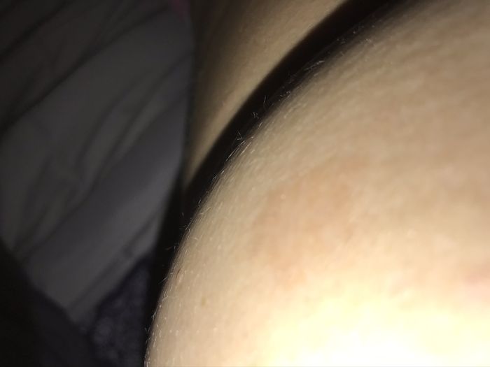 Stress breakouts or rashes? Venting. - 1