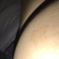 Stress breakouts or rashes? Venting. - 1
