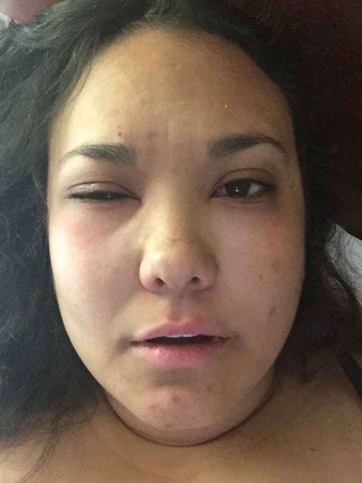 NWR- allergies and I guess some good wedding advice too regarding allergies...