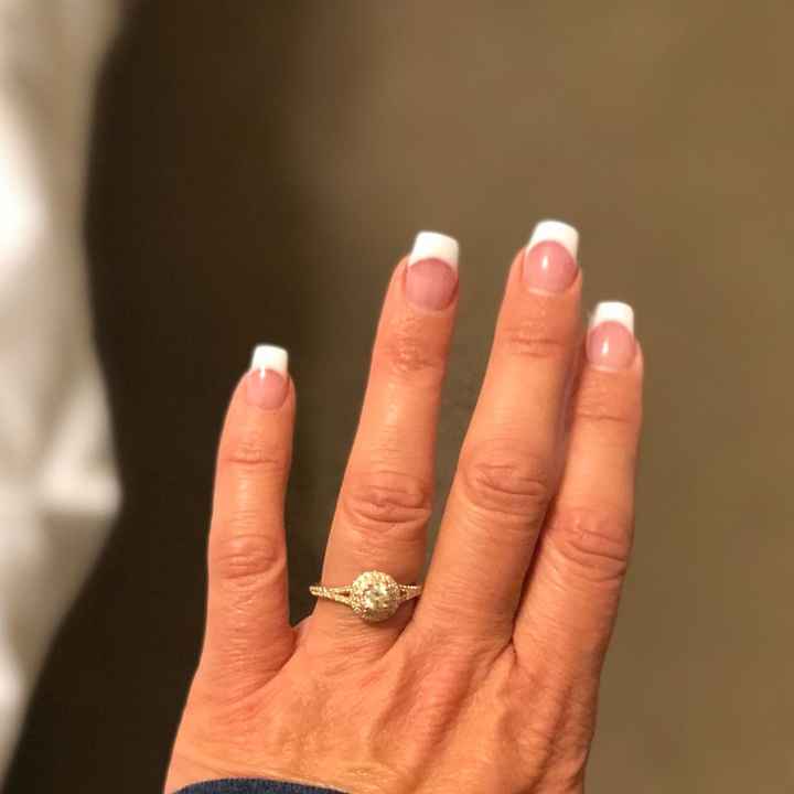 Let's see the Ring!!! Where are the alternative rings?!?! - 1