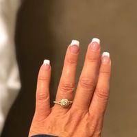 Let's see the Ring!!! Where are the alternative rings?!?! - 1