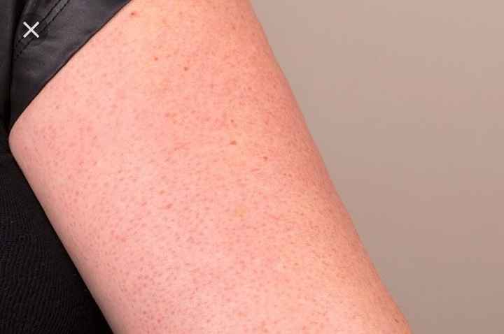 Recommendations for red spots