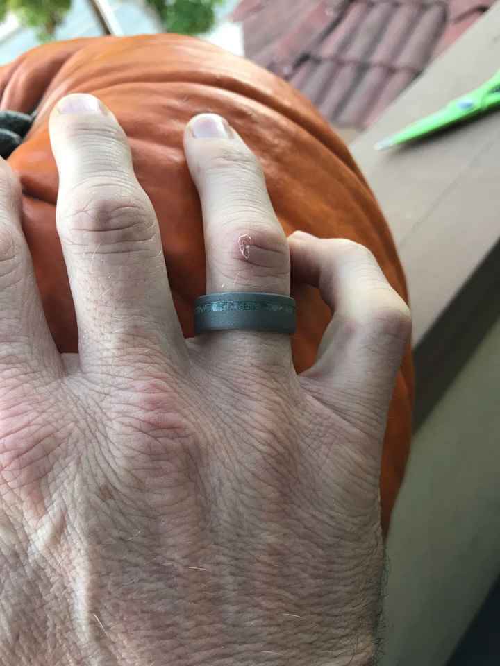 Show us his ring