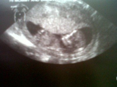 BR: Update