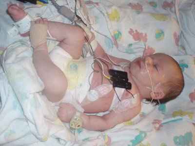 BR: Update on Mason...