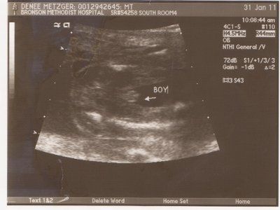 Ultrasound-the verdict is in!