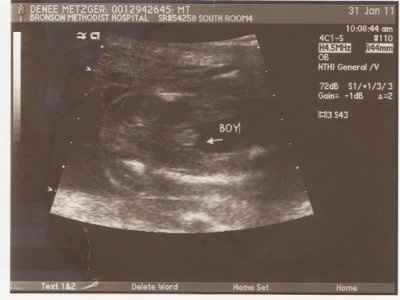 Ultrasound-the verdict is in!