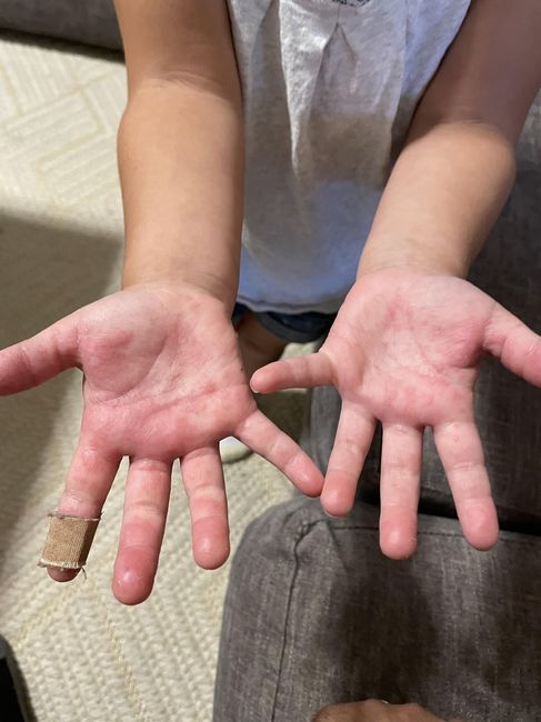 Help!!! Urgent!! - 1