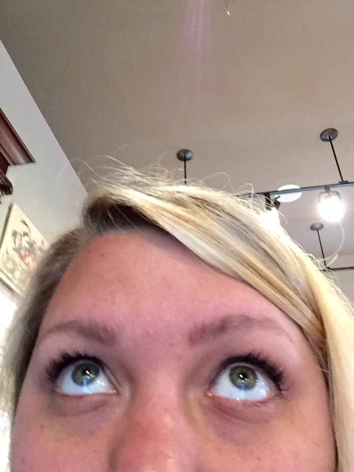 Anyone else struggle with eye bags? **Update with pic after juenesse trial