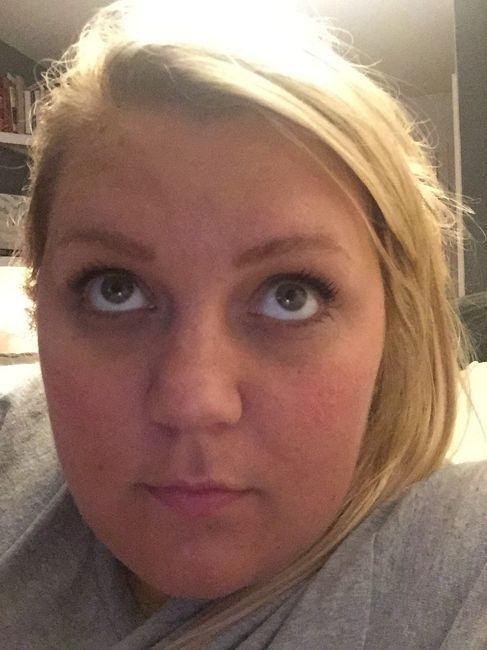Anyone else struggle with eye bags? **Update with pic after juenesse trial