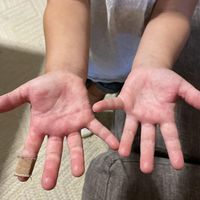 wedding tomorrow and sick as hell help need Advice! - 1