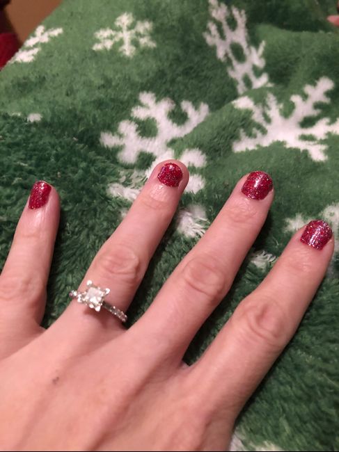 Ripped my nail off - 9 days out 1