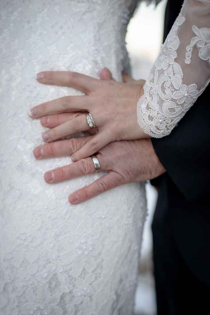 What color metal is your e-ring/wedding set?