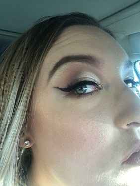 Second Trial (other eye)