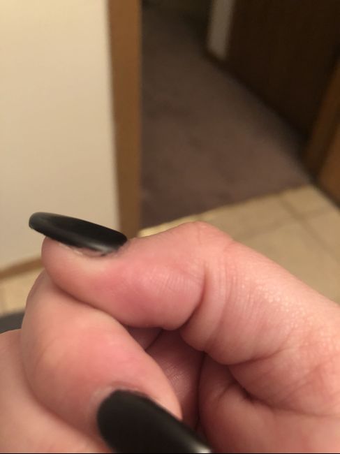 Nail frustration - 2