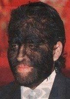 just bought a laser hair removal package.  EEK!