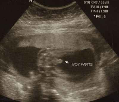 one a bride, now a lurker, need your advice: