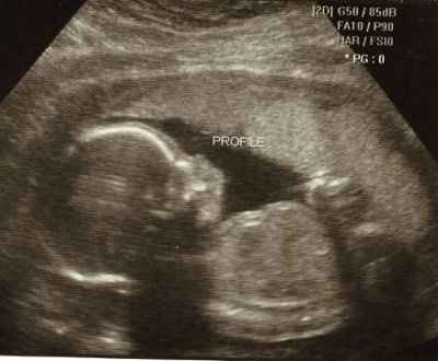 one a bride, now a lurker, need your advice: