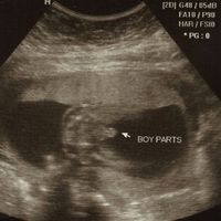 one a bride, now a lurker, need your advice: