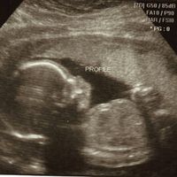 one a bride, now a lurker, need your advice: