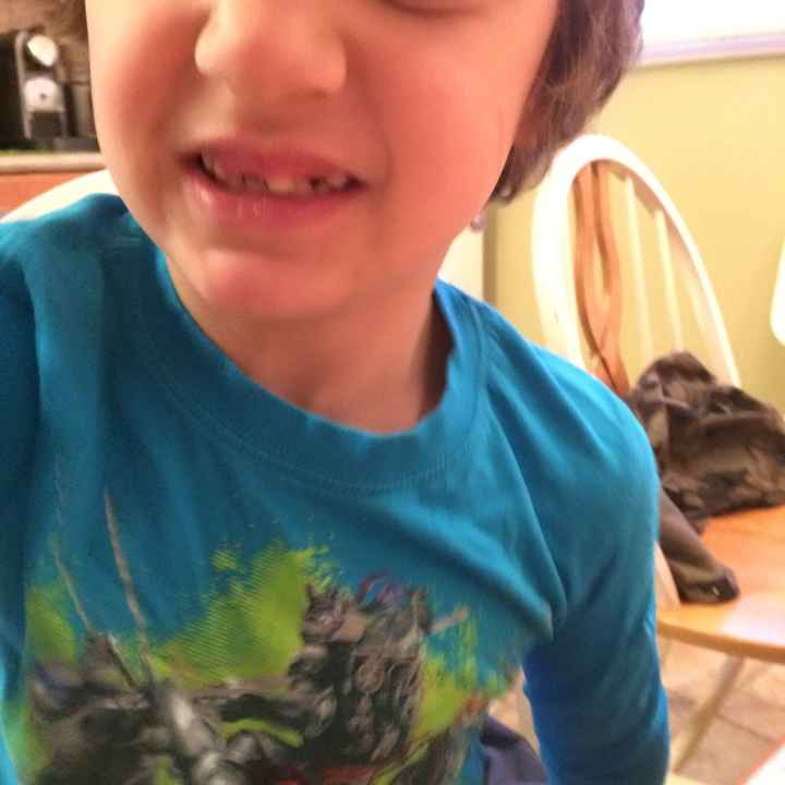 KWR my son will be "toothless" for the wedding.