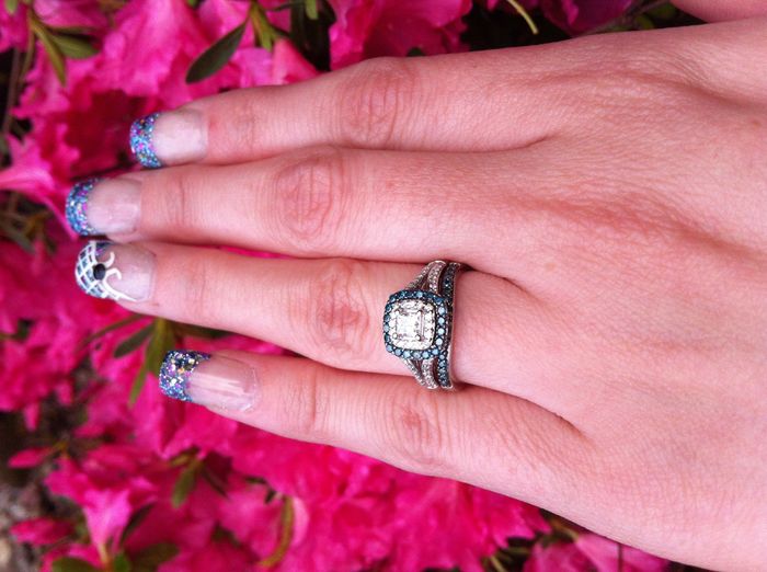 5 months out...and I got a new RING!!! What do you think? (PICS)