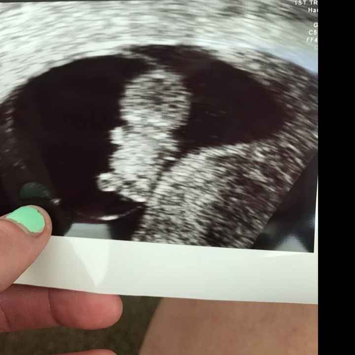 How big is your baby bump at 5 months? Should i tell most people before the wedding? - 1