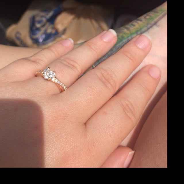 Ring distraction - 1