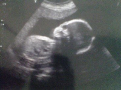 Any new baby updates?