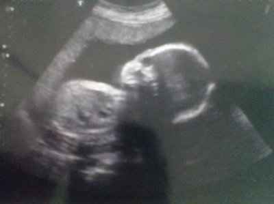 Any new baby updates?