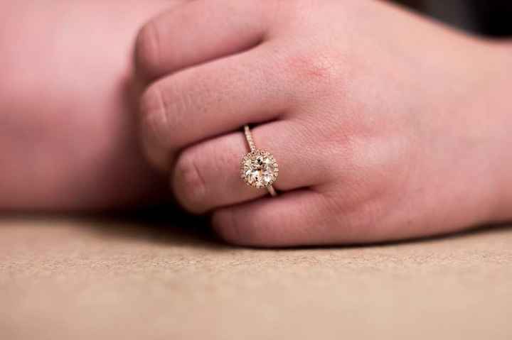 Do I have to have a wedding band?