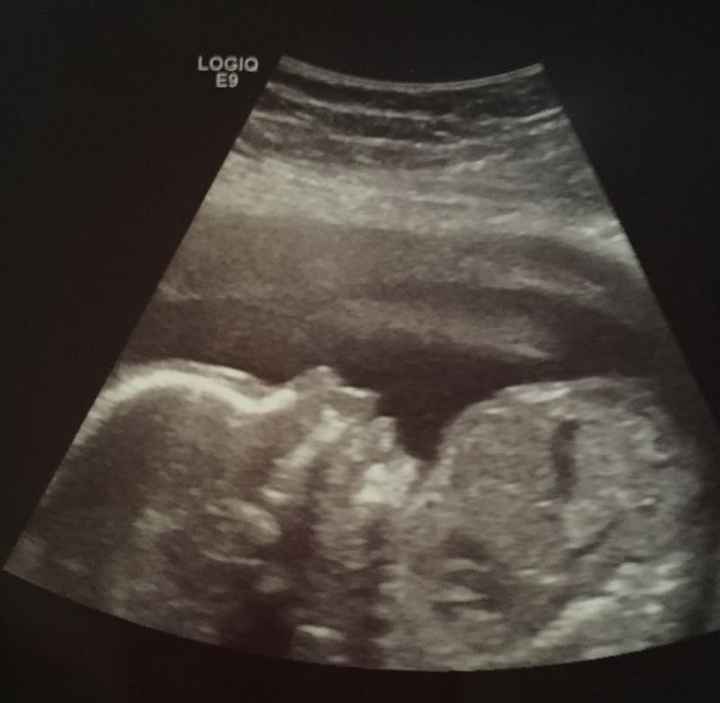 NWR: halfway through my pregnancy update: pregnant ladies share out