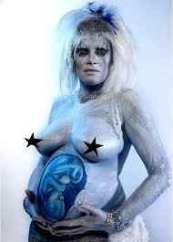 KWR But pregnancy related---Photos