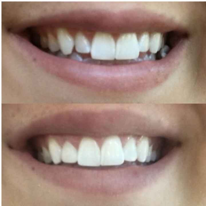 Insecurities anyone?!!