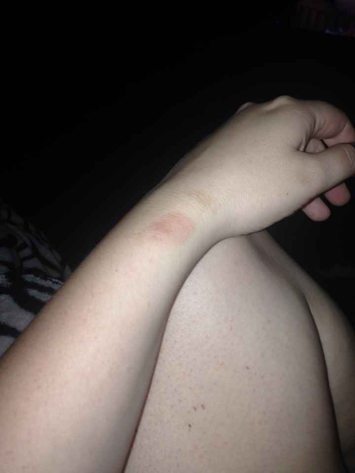 Ouch!